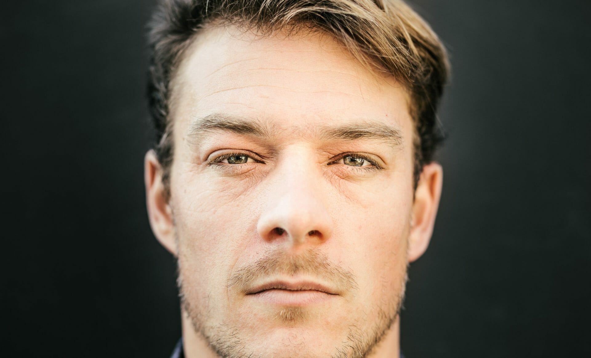 How to Cure Puffy Eyes at Home Buy Contact Lenses in Pakistan Lenspk